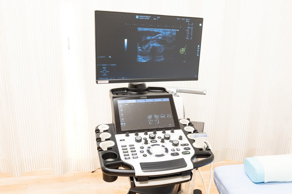 超音波診断装置(エコー)