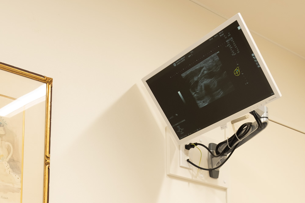 超音波診断装置(エコー)