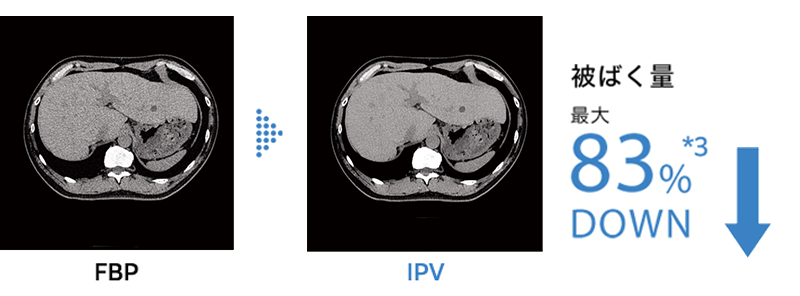 被ばく量最大83%ダウン